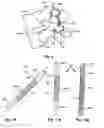 Fig. 08 - Flexible implant