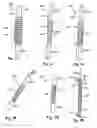 Fig. 10 - Flexible implant