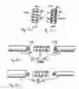Fig. 13 - Flexible implant
