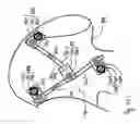 Fig. 20 - Flexible implant