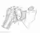 Fig. 01 - Adaptor prosthesis kit
