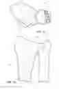 Fig. 04 - Distal radioulnar joint prosthesis
