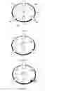Fig. 04 - Compass tool display object for navigating a tooth model