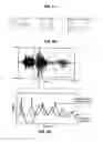 Fig. 04 - Topological voiceprints for speaker identification