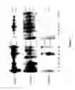 Fig. 08 - Variants of the Gamma Chain of AMPX, DNA sequences encoding the same, and uses thereof
