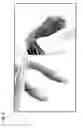 Fig. 03 - Transgenic nonhuman mammal representing the pathologic conditions of human rheumatoid arthritis