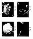 Fig. 02 - gene and its use in manipulating carotenoid content and composition in plants and other organisms