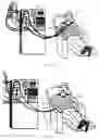 Fig. 02 - Garment for Dialysis Patients