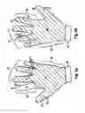 Fig. 03 - Endoscopy glove