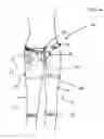 Fig. 02 - Hosiery Garment and Method of Making the Same