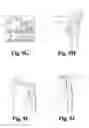 Fig. 10 - Dance shoe with moldable foot compartment