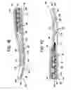 Fig. 03 - Flexible and/or laterally stable foot-support structures and products containing such support structures
