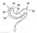 Fig. 01 - Earring apparatus