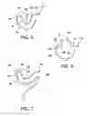 Fig. 03 - Earring apparatus