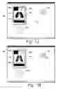 Fig. 12 - Respiratory apparatus
