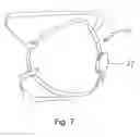 Fig. 09 - DROPLET COLLECTION DEVICES AND METHODS TO DETECT AND CONTROL AIRBORNE COMMUNICABLE DISEASES UTILIZING RFID