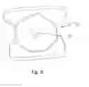Fig. 11 - DROPLET COLLECTION DEVICES AND METHODS TO DETECT AND CONTROL AIRBORNE COMMUNICABLE DISEASES UTILIZING RFID