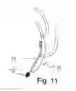 Fig. 13 - DROPLET COLLECTION DEVICES AND METHODS TO DETECT AND CONTROL AIRBORNE COMMUNICABLE DISEASES UTILIZING RFID