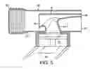 Fig. 05 - NASAL DRUG DELIVERY