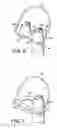 Fig. 06 - NASAL DRUG DELIVERY