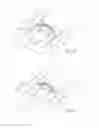 Fig. 10 - Retracting eye drape