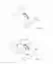 Fig. 17 - Retracting eye drape
