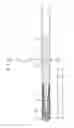 Fig. 02 - Guide wire