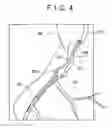 Fig. 05 - Guide wire