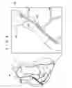 Fig. 08 - Guide wire