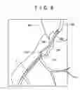 Fig. 09 - Guide wire
