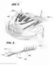 Fig. 04 - Engine compartment temperature sensitive louvers