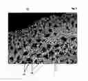 Fig. 04 - Antimicrobial activated carbon and use thereof