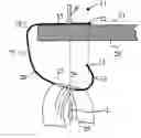 Fig. 01 - Bag Holder