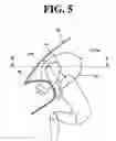 Fig. 06 - Airbag device