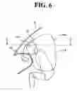 Fig. 07 - Airbag device