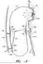 Fig. 06 - Airbag with floating tethers