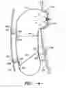 Fig. 07 - Airbag with floating tethers