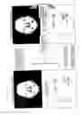 Fig. 07 - Face feature point detection device and method