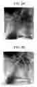 Fig. 06 - Fingerprint collation apparatus, fingerprint pattern area extracting apparatus and quality judging apparatus, and method and program of the same