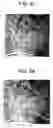 Fig. 07 - Fingerprint collation apparatus, fingerprint pattern area extracting apparatus and quality judging apparatus, and method and program of the same