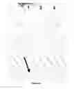 Fig. 12 - Dominant B cell epitopes and methods of making and using thereof