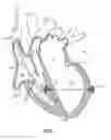 Fig. 02 - System for Treating Mitral Valve Regurgitation