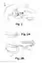 Fig. 02 - Subcutaneous lead fixation mechanisms