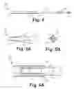 Fig. 04 - Subcutaneous lead fixation mechanisms