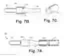 Fig. 06 - Subcutaneous lead fixation mechanisms