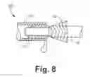 Fig. 07 - Subcutaneous lead fixation mechanisms