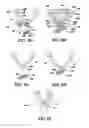 Fig. 09 - Temporary Ornament Display Apparatus and Method
