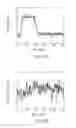 Fig. 11 - Localization of a radioactive source within a body of a subject