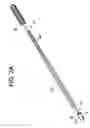 Fig. 04 - Minimally invasive tissue expander systems and methods