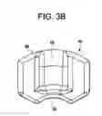 Fig. 07 - Minimally invasive tissue expander systems and methods